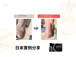 Esthe Pro Labo <BR> WOTT 最先進健康睡眠循環恢復 - 水分子震動分解美容保健儀 <BR>  (Launch Promotion 優惠 92 折) <BR>( Pre-Order 接受預購 )