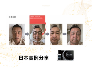 Esthe Pro Labo <BR> WOTT 最先進健康睡眠循環恢復 - 水分子震動分解美容保健儀 <BR>  (Launch Promotion 優惠 92 折) <BR>( Pre-Order 接受預購 )
