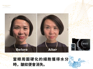 Esthe Pro Labo <BR> WOTT 最先進健康睡眠循環恢復 - 水分子震動分解美容保健儀 <BR>  (Launch Promotion 優惠 92 折) <BR>( Pre-Order 接受預購 )
