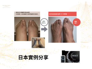 Esthe Pro Labo <BR> WOTT 最先進健康睡眠循環恢復 - 水分子震動分解美容保健儀 <BR>  (Launch Promotion 優惠 92 折) <BR>( Pre-Order 接受預購 )