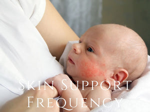 Frequency - Eczema Support Program <BR> 濕疹舒緩頻率程式 - newearthstore